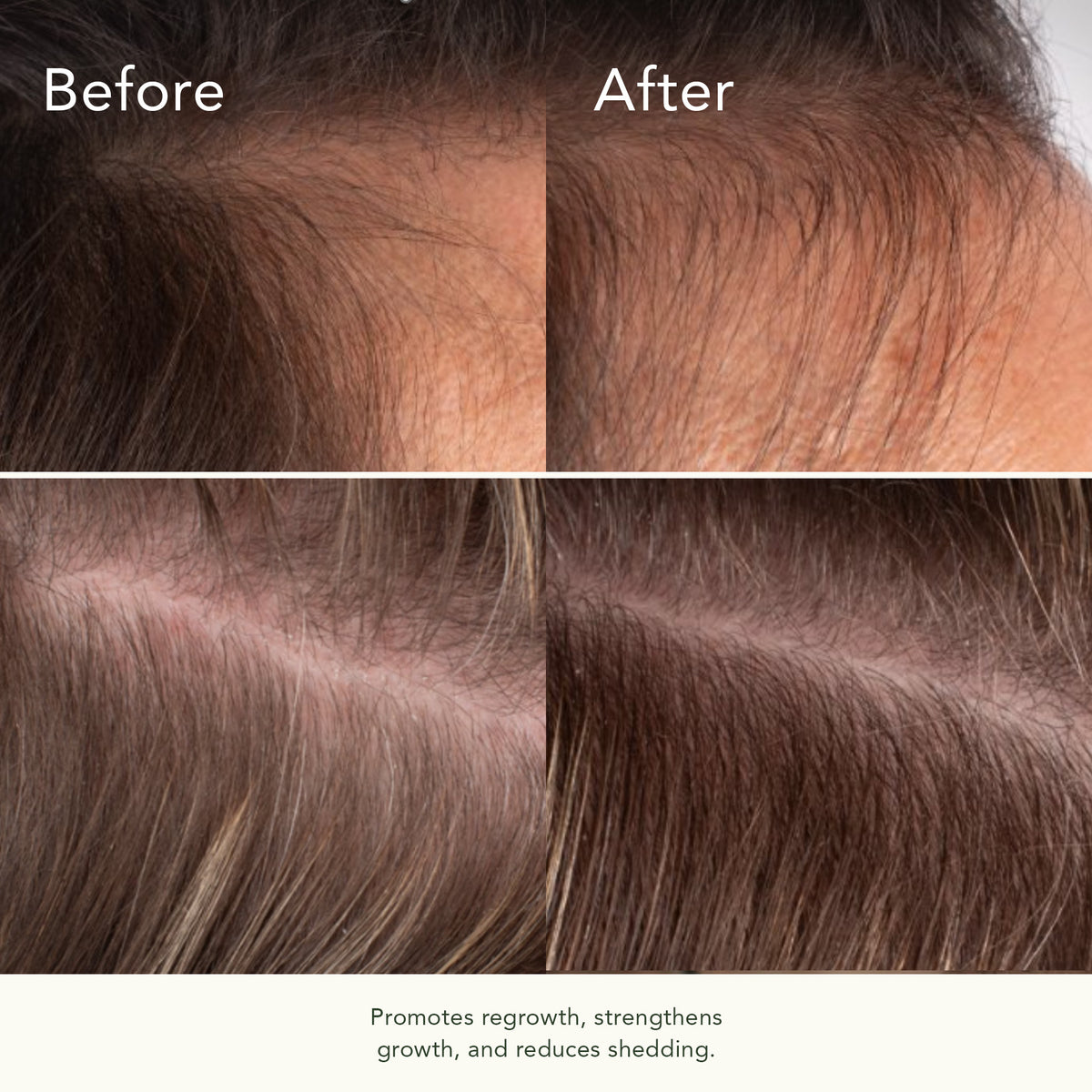 Bio-Ferment Scalp &amp; Hair Treatment